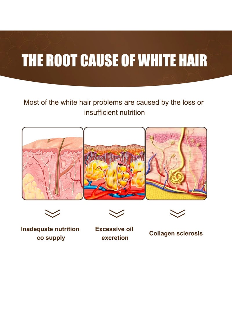 Jaysuing Anti White Hair Serum, Nourishing Anti Grey Hair Essence Oil, Smooth And Effective Hair Growth Oil, Moisturizing Hair Repair Essence For Thicker, Darker And Healthier Hair - Image 3
