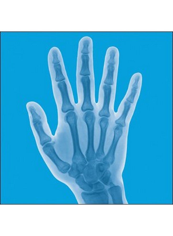 Lindberg Ultrajoint 210 Capsules A Comprehensive Tripleaction Joint Formula - Image 5