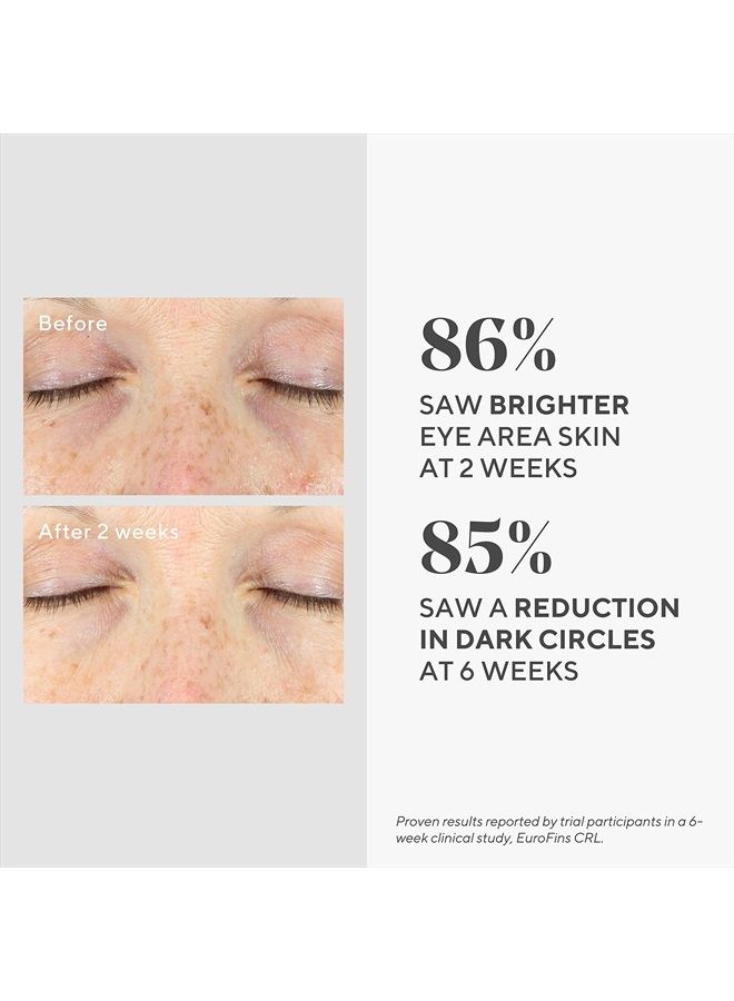 Murad Vita-C Eyes Dark Circle Corrector – Environmental Shield Vitamin C Brightening Serum – Anti-Aging Treatment for Puffiness and Wrinkles, 0.5 Fl Oz - Image 4