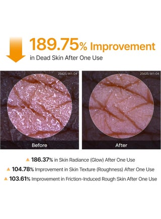 Dr.Melaxin Body Keratin Care Kojic Acid Turmeric Spray Gently Exfoliating Peeling Solution Korean Skincare All Skin Types 200ml - view 5