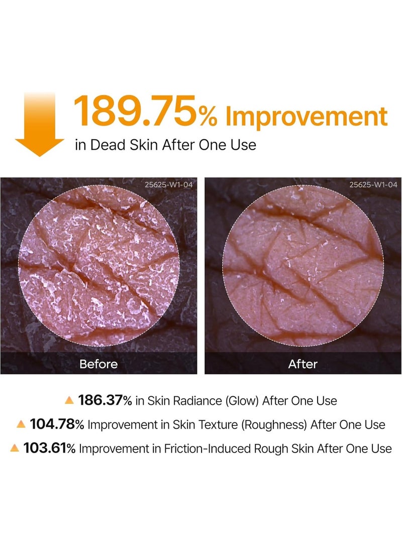 Dr. Melaxin Dr.Melaxin Body Keratin Care Kojic Acid Turmeric Spray Gently Exfoliating Peeling Solution Korean Skincare All Skin Types 200ml - Image 5
