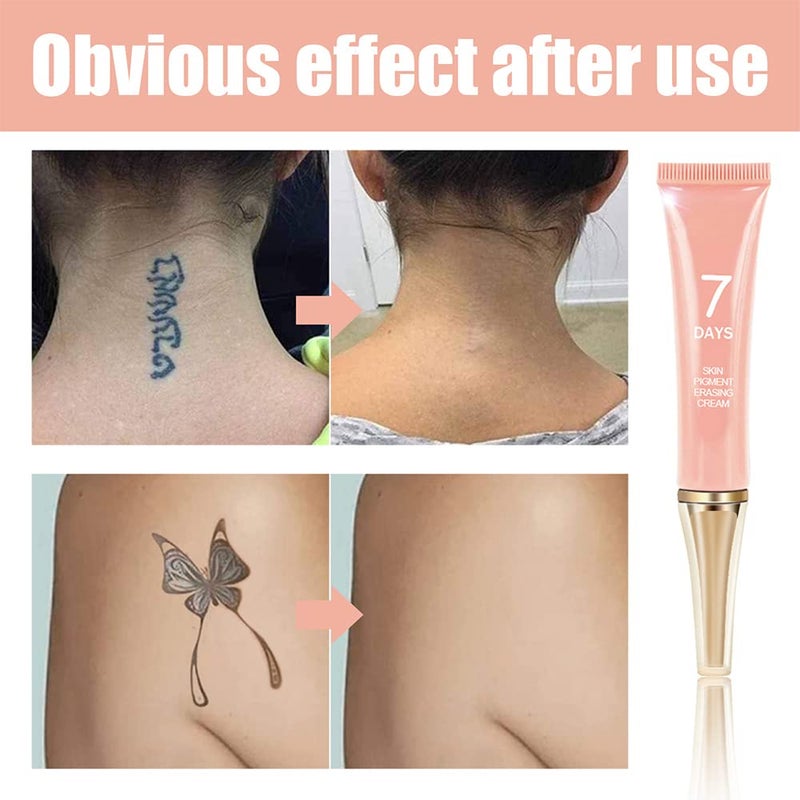 KlsyChry Tattoo Removal Cream That Works Fast, Permanent Tattoo Removal Cream, Skin Pigment Erasing Creams, Painless Removal Tattoos, Rapid Absorption, Leaving No Scars - Image 3