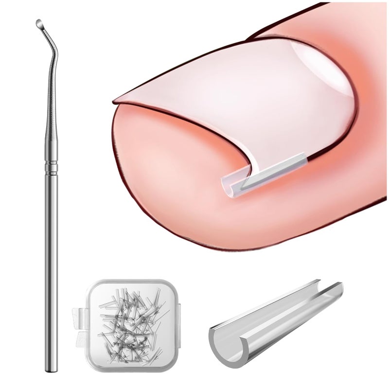 BEZOX Ingrown Toenail Corrector Set - 40 Pcs Pain-Free Toenails Straightener Strips with Toe Nail Lifter - Easy Use Ingrown Toenail Tools Kit - Image 1