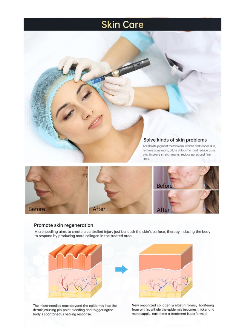 Dr.pen A8S Wireless Microneedle with 2 Pieces of 18-Pin Needles