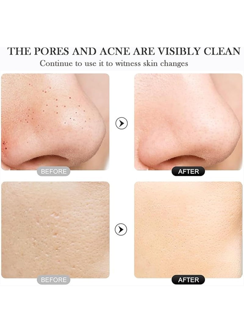 جهاز سكرابر بالموجات فوق الصوتية لإزالة الرؤوس السوداء – 4 أوضاع لتنظيف المسام بعمق وتقشير البشرة، قابل للشحن USB - Image 2