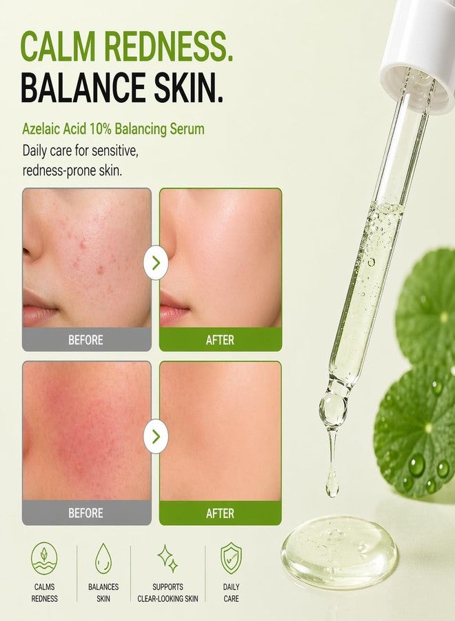 daymellow Azelaic Acid 10% Balancing Serum for Face - Redness Relief & Acne Scar Treatment with Cica, Ectoin, Niacinamide - Soothing Facial Serum for Sensitive Skin, 1.01 fl oz - Image 4