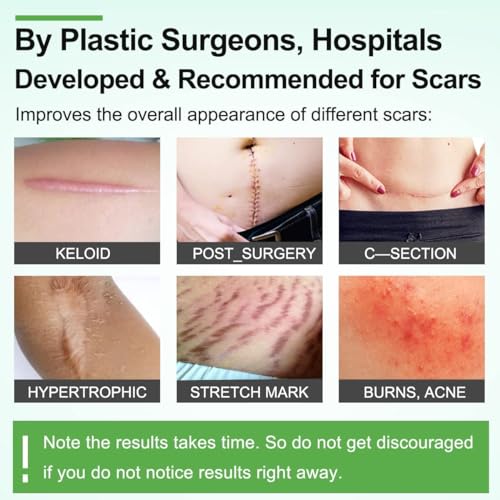 Nexllent Silicone Scar Sheets, Silicon gel sheets for Scars Transparent Medical Silicone Gel Tape for Scar Removal, Silicone Scar Tape Roll For Hypertrophic Scars and Keloids Caused by Surgery - Image 2