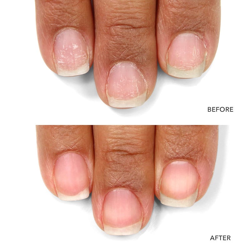 LONDONTOWN kur Nail Probiotic Instant Boost, Nail Care Mask For Weak/Thin Nails, Instant Hydration Boost Protective Care for Dry Damaged Nails - Image 2