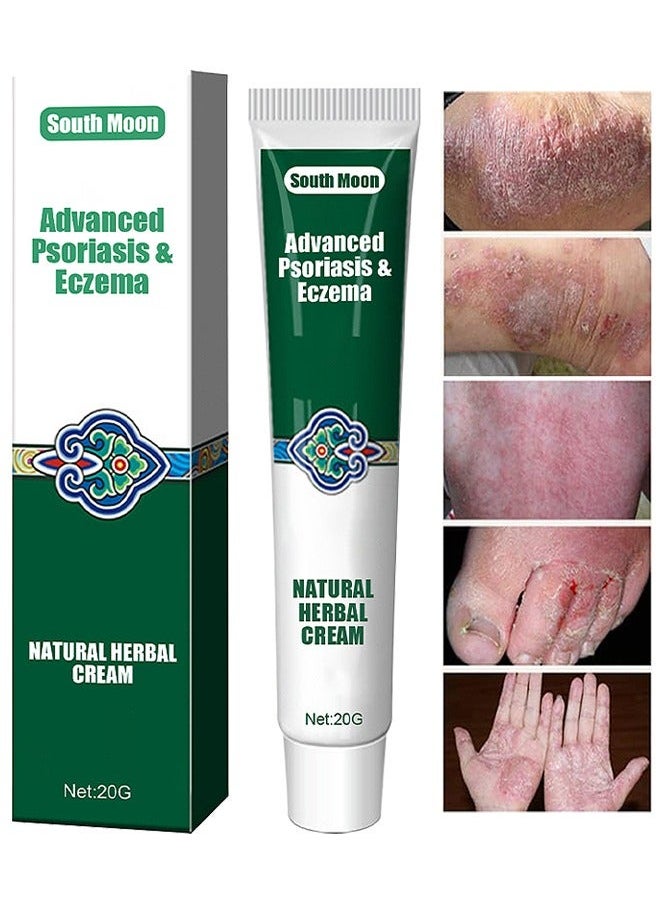 SOUTH MOON Organic Psoriasis And Eczema Herbal Healing Cream, Chinese Herbal Eczema, Natural Herbal Cream, Psoriasis Ointment Cream, Moisturising Cream, Itch And Rash Ointment, Itch Relief Cream 20G  - Image 1