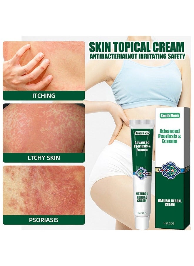 SOUTH MOON Organic Psoriasis And Eczema Herbal Healing Cream, Chinese Herbal Eczema, Natural Herbal Cream, Psoriasis Ointment Cream, Moisturising Cream, Itch And Rash Ointment, Itch Relief Cream 20G  - Image 4