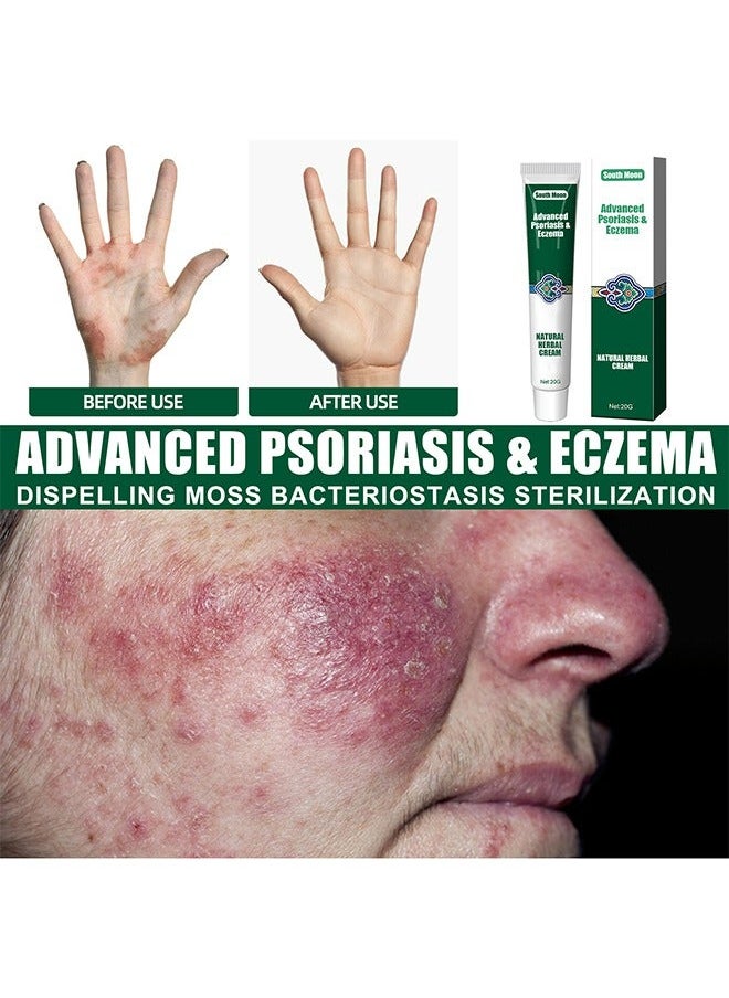 SOUTH MOON Organic Psoriasis And Eczema Herbal Healing Cream, Chinese Herbal Eczema, Natural Herbal Cream, Psoriasis Ointment Cream, Moisturising Cream, Itch And Rash Ointment, Itch Relief Cream 20G  - Image 3