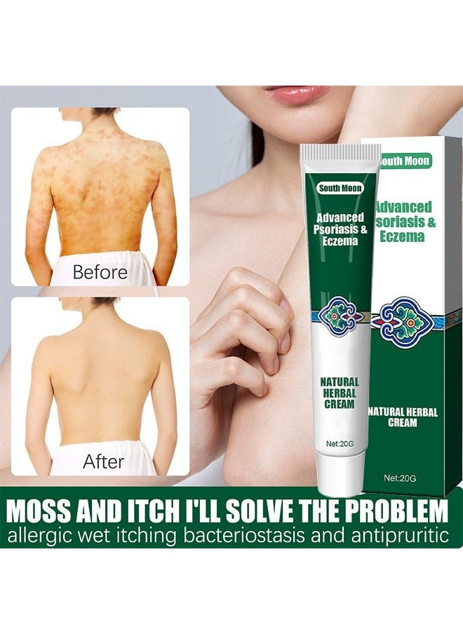 SOUTH MOON Organic Psoriasis And Eczema Herbal Healing Cream, Chinese Herbal Eczema, Natural Herbal Cream, Psoriasis Ointment Cream, Moisturising Cream, Itch And Rash Ointment, Itch Relief Cream 20G  - Image 5
