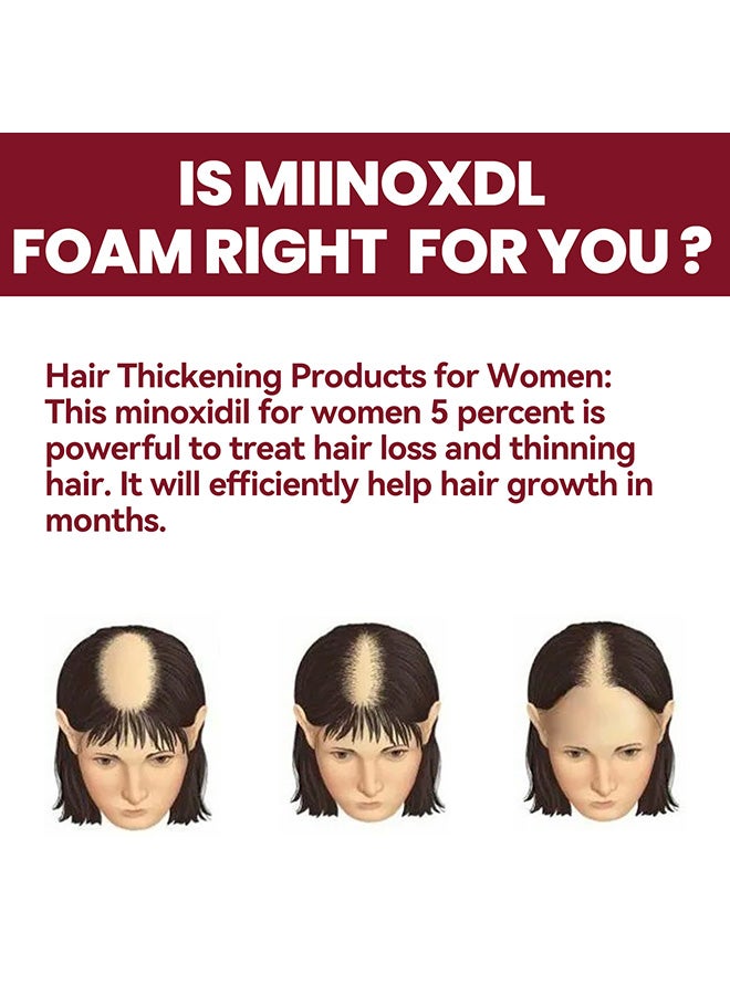 EELHOE Hair regeneration foam revivies and restores hair follicles for women hair health care four month supply 60g - Image 4