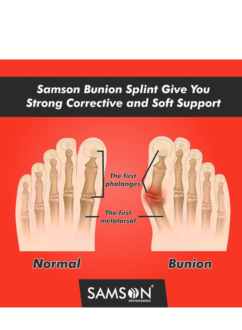 سامسون دعامة تصحيح انحراف الإصبع الكبير (Bunion) من Samson | تقويم مرن لتعديل الانحراف + تخفيف الضغط والألم | خامات مريحة وتصميم قابل للتعديل - Image 4
