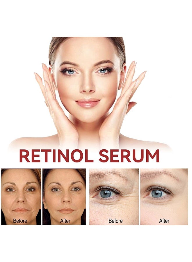 EELHOE Retinol Serum  - Retinol Face Serum For Anti Wrinkle, Dark Spot Serum For Brightening And Rejuvenating Skin - Anti Aging, Moisturize ，30ml - Image 5