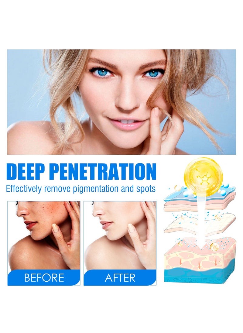 OUHOE - Lightening spot cream, whitening skin, reducing melanin, chloasma, spots, moisturizing and hydrating cream - Image 1