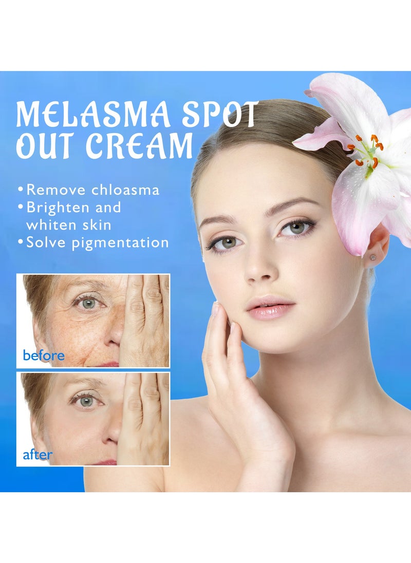 OUHOE - Lightening spot cream, whitening skin, reducing melanin, chloasma, spots, moisturizing and hydrating cream - Image 1