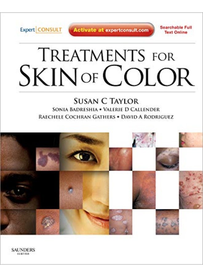 Treatments for Skin of Color: Expert Consult - Online and Print  - Image 1