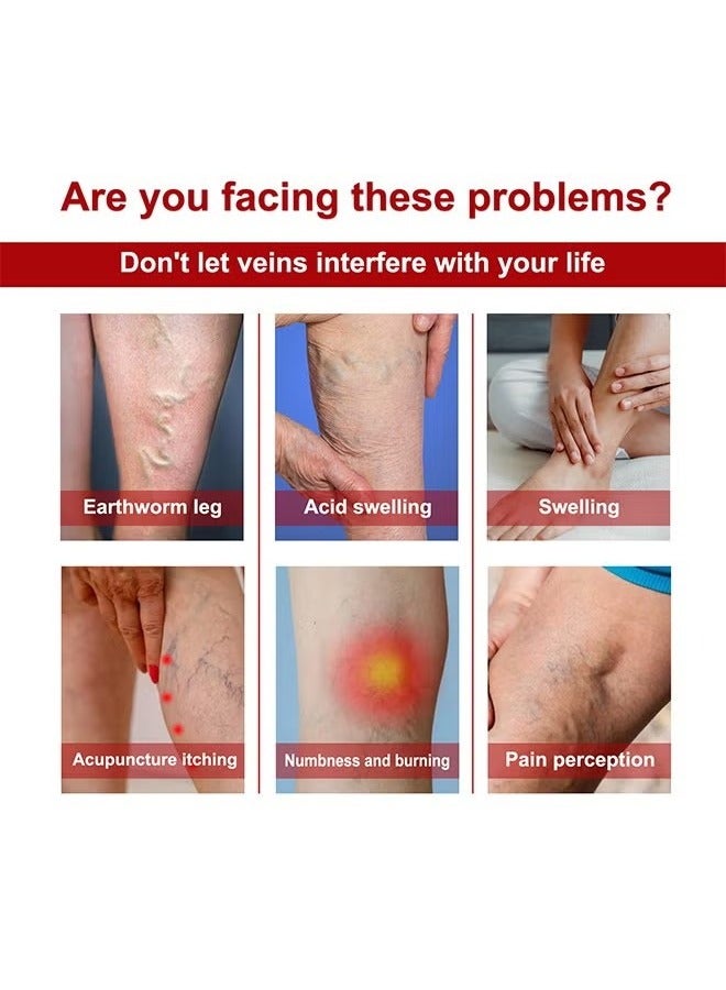 SOUTH MOON Varicose Veins Cream，Relieve Tired Legs Relieve Dilated Capillaries Minimize Varicose &Spider Veins ​Relief Cream 20g - Image 4
