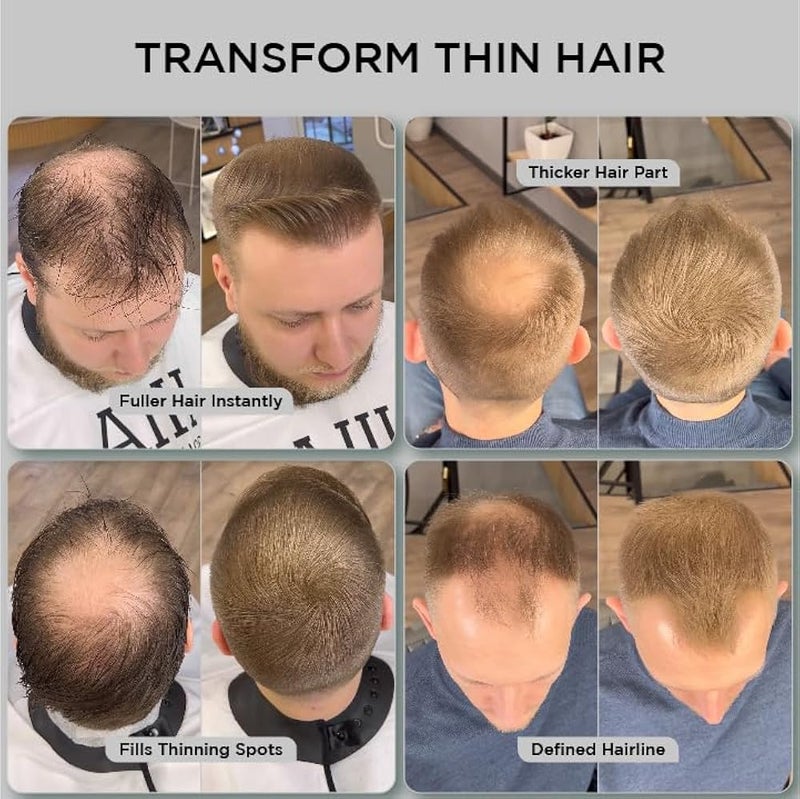 THICK FIBER Hair Fibres | Hair Powder for Thinning Hair 25g Bottle | Makes Thin Hair Look Thicker in Seconds | Hair Loss Concealer For Women & Men (Light Brown) - Image 2