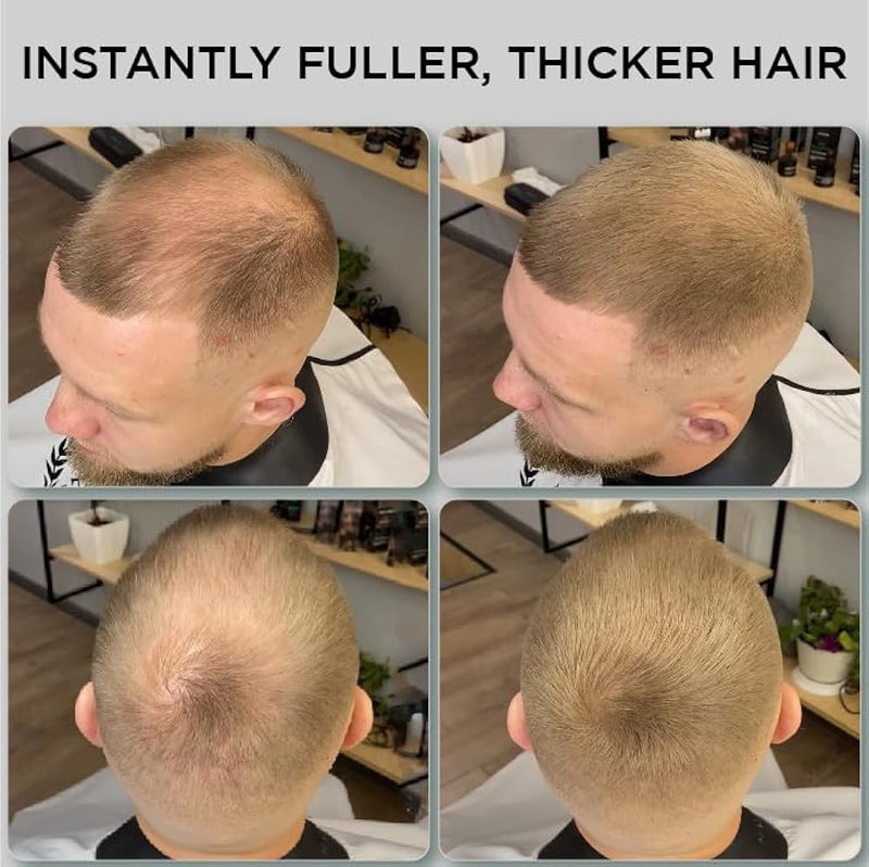 THICK FIBER Hair Fibres | Hair Powder for Thinning Hair 25g Bottle | Makes Thin Hair Look Thicker in Seconds | Hair Loss Concealer For Women & Men (Light Brown) - Image 4
