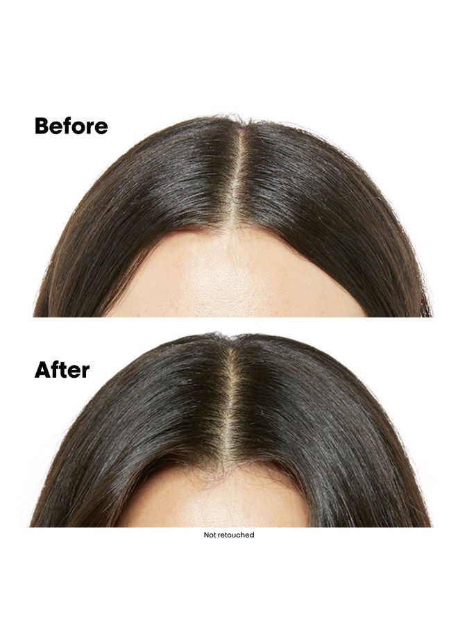 لوريال بروفيسيونال شامبو لفروة الشعر الحساسة - Image 4