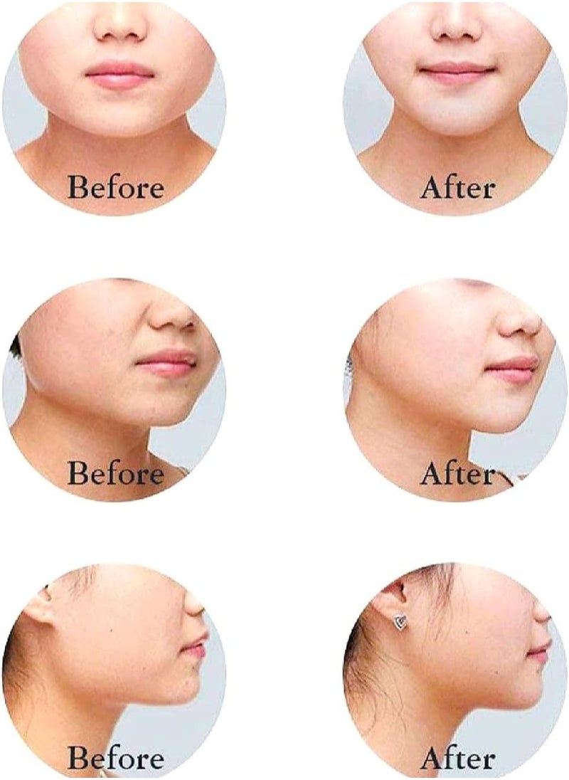 Kimaya - Reusable V Line Mask Facial Slimming Strap Double Chin Reducer Chin Up Mask Face Lifting Belt - Image 1
