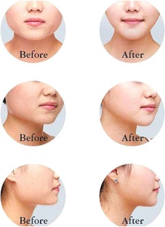 Reusable V Line Mask Facial Slimming Strap Double Chin Reducer Chin Up Mask Face Lifting Belt - pzsku/Z4552745F01FFE1130582Z/45/_/1728624831/c5ce884f-c012-40f5-8170-ba03a4eb72d1