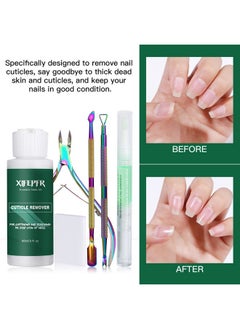 Xifepfr XIFEPFR Cuticle Remover Kit - Cuticle Remover Cream & Cuticle Oil Pen for Soften Moisturize, Cuticle Trimmer/Nipper, Cuticle Pusher and Nail Cotton Pads for Professional Manicure, Gifts for Women  - Image 3
