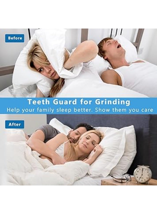 واقي الفم لصقل الاسنان في الليل ، واقيات الفم لطحن الاسنان، واقي فم قابل لاعادة الاستخدام للنوم، واقي للعض، مجموعة من 4 قطع بمقاسين - Image 4