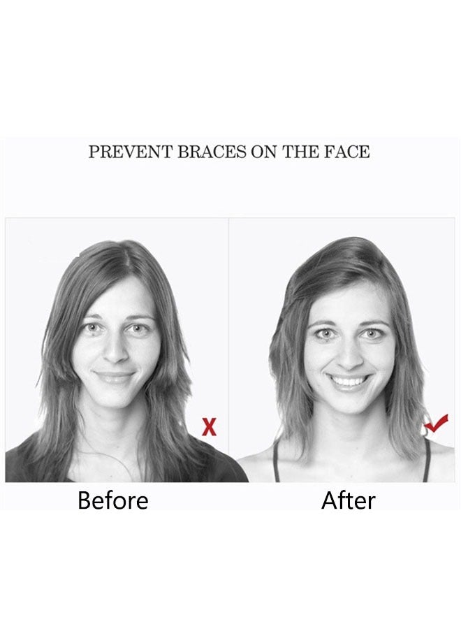 18 قطعة من المضغ تقويم الأسنان من ناحية عقد اللثة ، تقويم الأسنان قناع الوجه ، الغذاء الصف هلام السيليكا ، الوجه تصحيح الجمال - Image 2