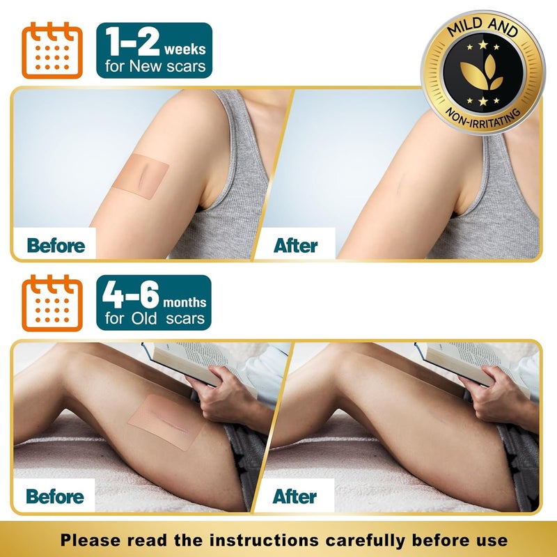 Arme Silicone Scar Tape Silicone Scar Sheets for Surgical Scars16x180 Roll46M Medical Grade Scar Tape Reusable Sheets for Scar Treatment Soft Scars Tapes for CSection Keloid Tummy Tuck - Image 5