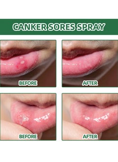 SOUTH MOON Canker Sores,Oral Antibacterial Spray - Breath Freshener,Mouth Ulcer Treatment and Pain Relief,Herbal Oral Care Spray,Fast Acting Relieves Sore Throat and Dry Mouth Problems,Effective for Mouth Ulcers  - Image 3