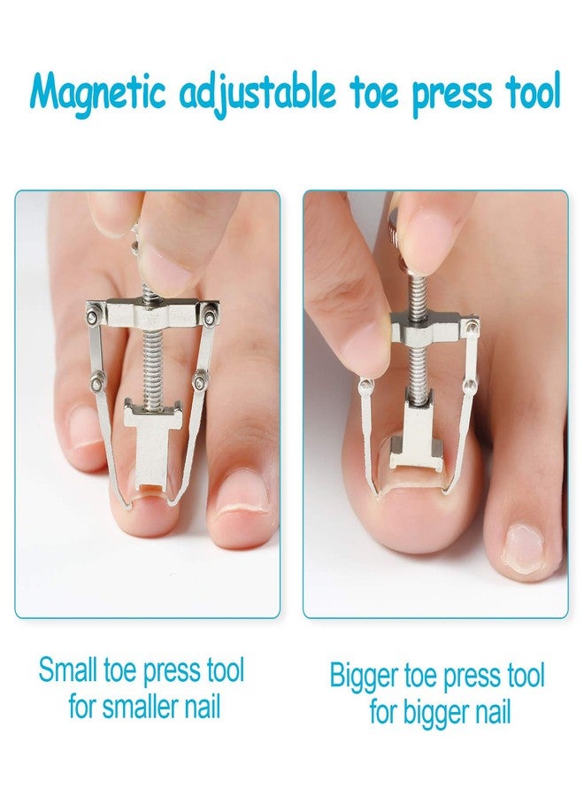 Mudder 2 Pieces Ingrown Toenail Lifter Ingrown Toenail Tool Toe Clamp Stainless Steel Foot Care Tool for Paronychia (Silver) - Image 4