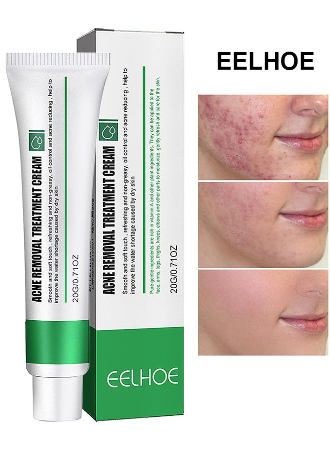 EELHOE Acne Removal Treatment Cream, Oil Control Acne Removal Acne Pimple Repair Cream, Acne Spot Treatment For Face And Acne Dots, Natural Cystic Acne Treatment Suitable For Oily And Acne Prone Skin 20G - Image 1