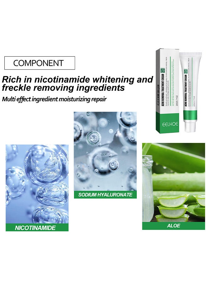 EELHOE Acne Removal Treatment Cream, Oil Control Acne Removal Acne Pimple Repair Cream, Acne Spot Treatment For Face And Acne Dots, Natural Cystic Acne Treatment Suitable For Oily And Acne Prone Skin 20G  - Image 3