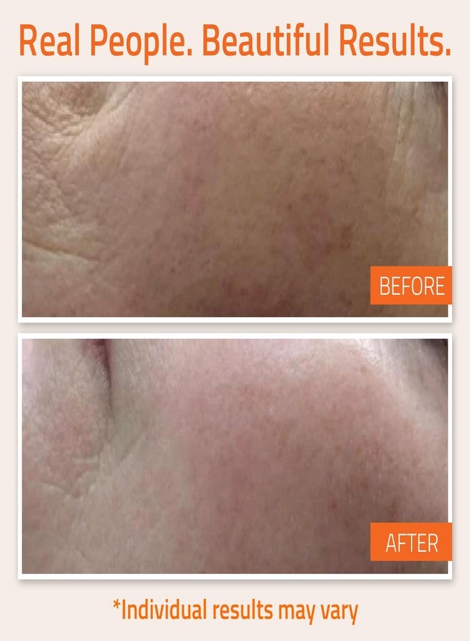 YEOUTH Vitamin C Face Serum with Hyaluronic Acid, Hydrating Vitamin C Serum for Face, Targets the Appearance of Dull Spots 2oz - Image 4