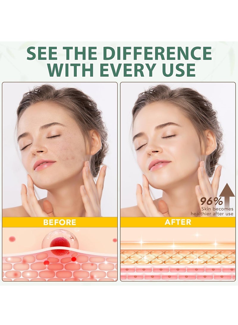 Beef Tallow Skin Care, Tallow Face Cream, Moisturize Your Skin, Provide Your Skin with Long-Lasting Moisturizing, Prevent Skin Aging, and Repair Skin, for All Skin Type - 4.2 oz - Image 2