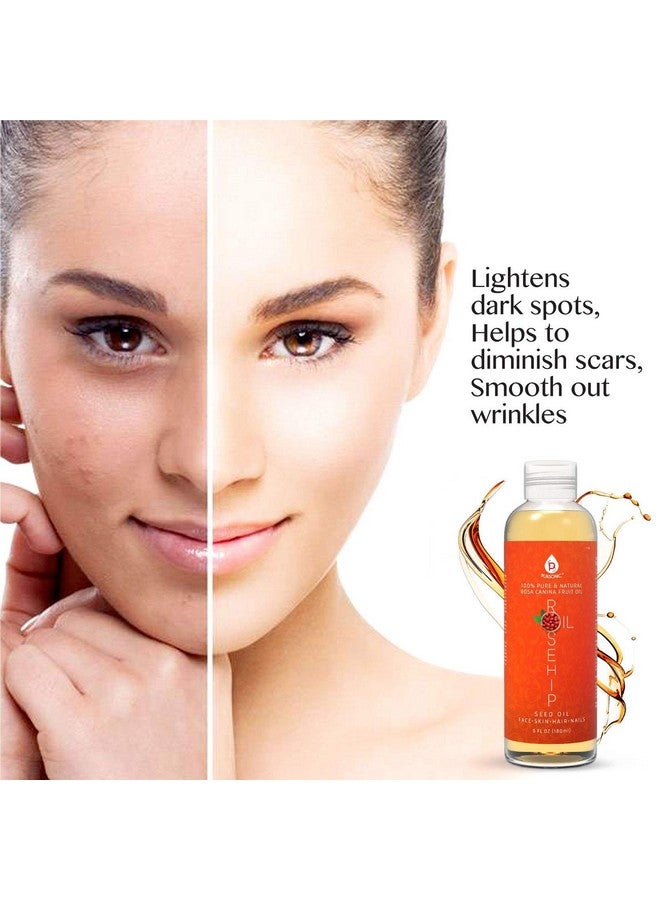 بورسونيك زيت ثمر الورد من بورسونيك للوجه والأظافر والشعر والبشرة، 6 أونصة - Image 5