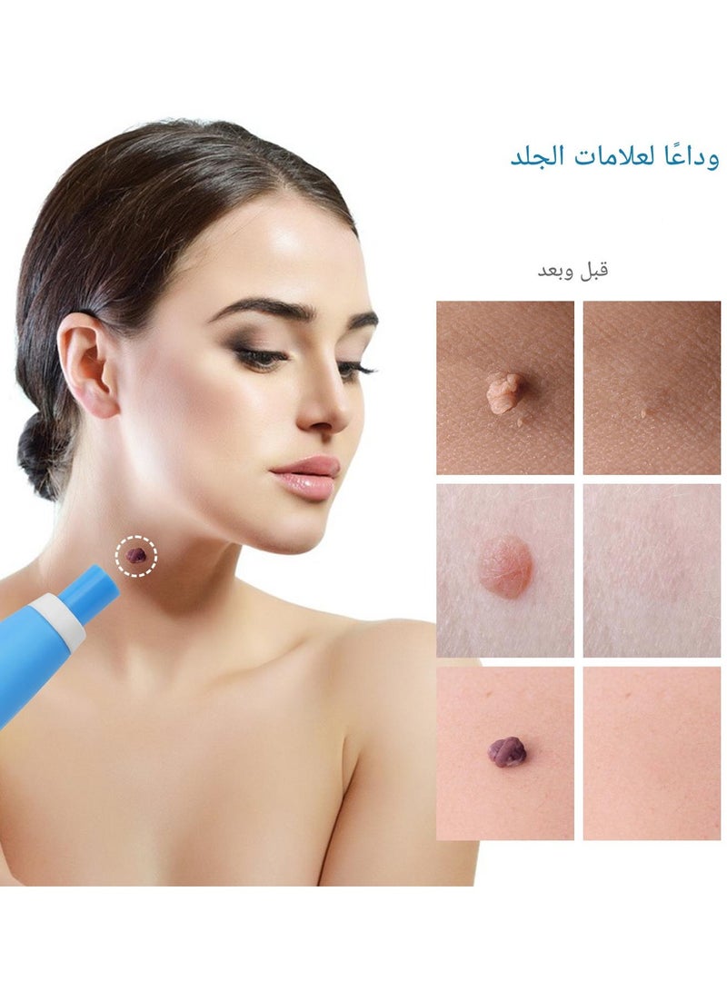 Skin Tag Removal Tool Kit Painless Skin Tag Removal Acne Wart Remover Handpiece with Cleansing Pads Facial Skin Care Tool Blue - Image 2