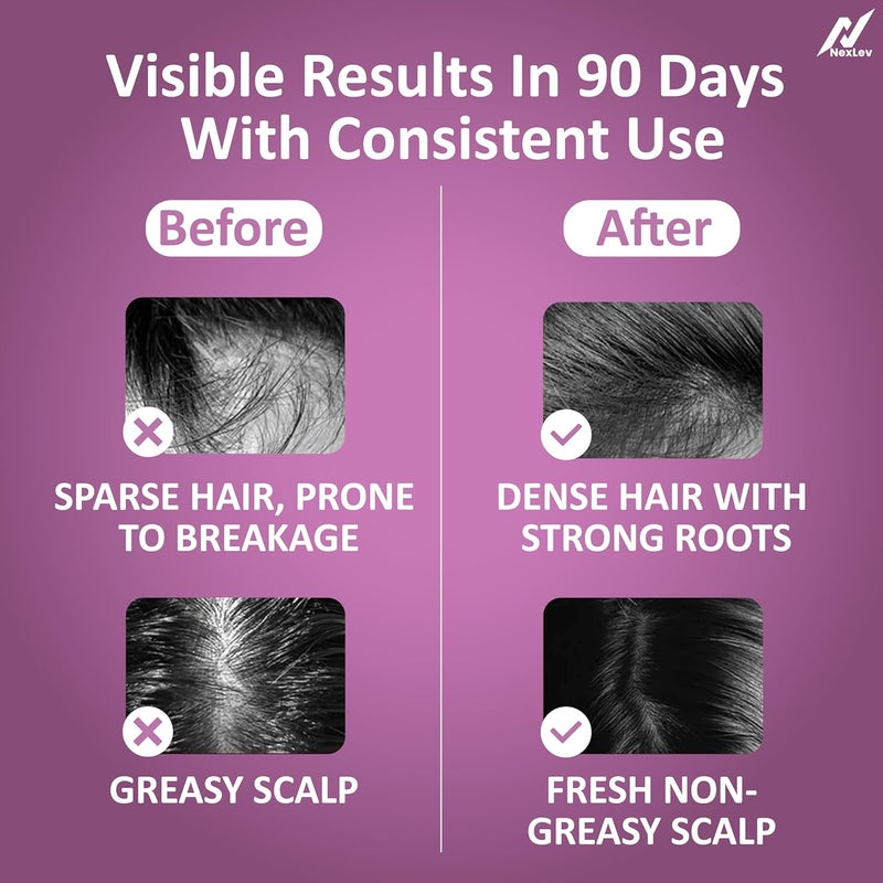 nexlev مشط تطبيق الزيت | علاج الضوء الأحمر LED | تعزيز نمو الشعر | تقليل قشرة الرأس | تخفيف التوتر | جهاز تدليك فروة الرأس/الرأس الكهربائي عالي الاهتزاز | خزان زيت سعة 6 مل | وقت تشغيل 2 ساعة | نوع-C | EA-02 - Image 5
