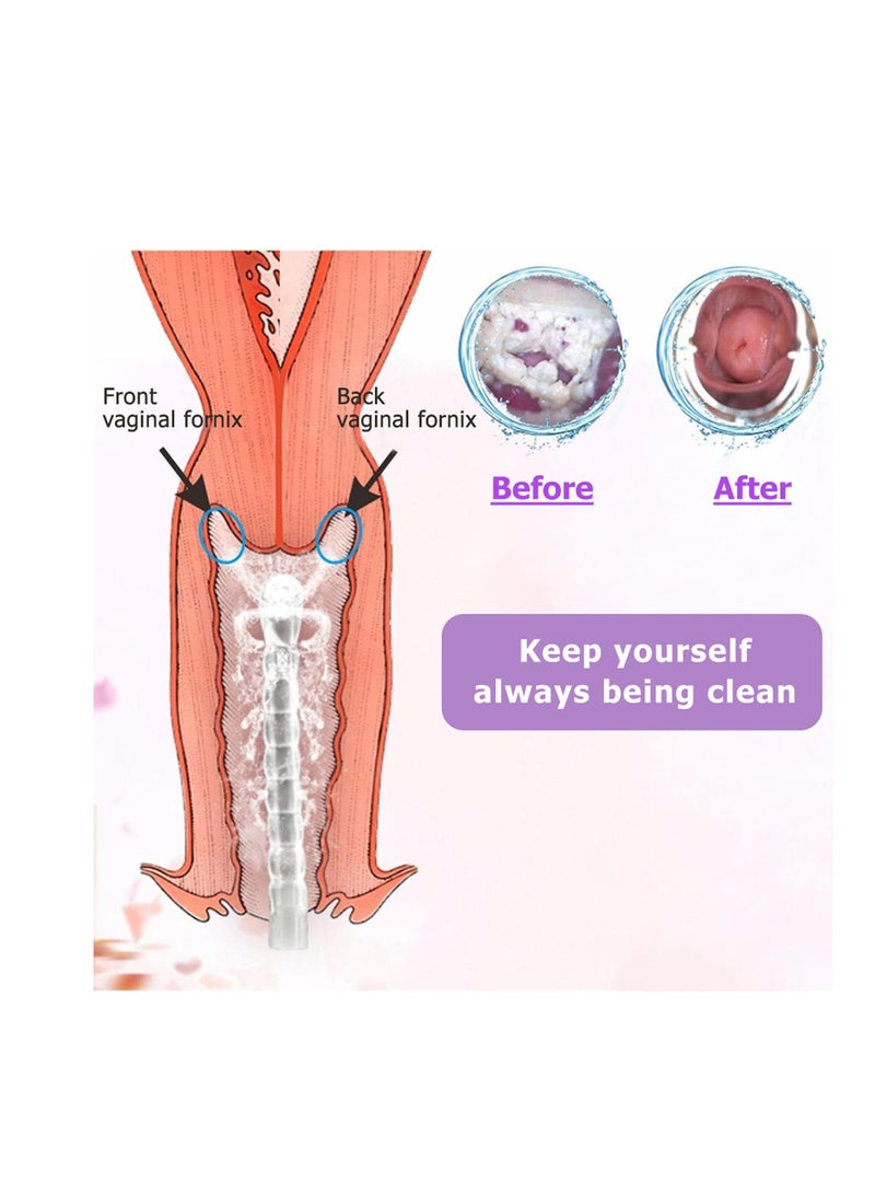 SYOSI 300ml  Douche Cleaner -  Douche Cleaning Kit Enema Bottle with 3 Nozzle Tips - Reusable Manual Pressure Enemas for Douche, Water Colon Cleansing Gifts for Women(300ml/10.1oz) - Image 5