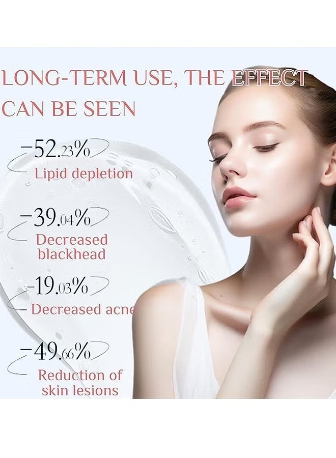FUSHITING Azelaic Acid 15% Acne Tratment Cream, Acne Cream for Face, Spot Treatment, Anti Acne Gel For Spot Prone Skin, Rosacea Reducing Relief Pimple Breakouts Blackhead Pigmentation and Redness,Hydrate 15g - Image 5