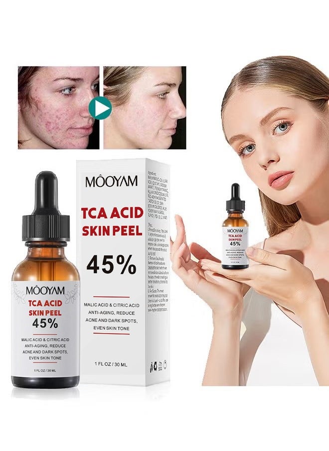 MOOYAM - 45% TCA Acid Skin Peel - Malic Acid & Citric Acid, Anti-Aging, Reduce Acne and Dark Spots, Even Skin Tone, TCA 45% Skin Peel, 45% TCA Chemical Peeling Serum with Malic and Citric Acid for Dark Skin, Dark Spots and Acne Spots, Natural Skin Care - 30 ml/1 fl oz - Image 1