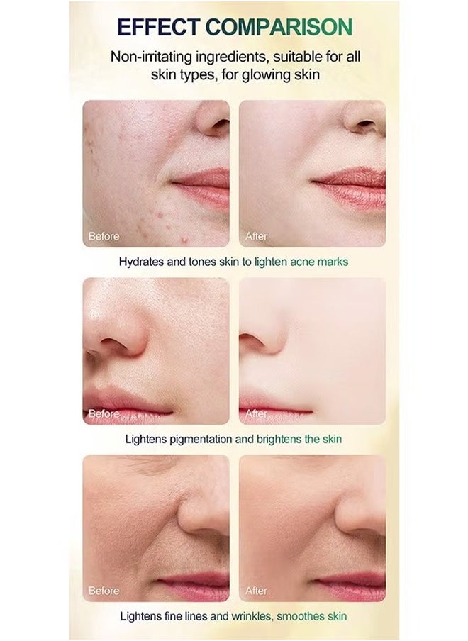 MOOYAM - 45% TCA Acid Skin Peel - Malic Acid & Citric Acid, Anti-Aging, Reduce Acne and Dark Spots, Even Skin Tone, TCA 45% Skin Peel, 45% TCA Chemical Peeling Serum with Malic and Citric Acid for Dark Skin, Dark Spots and Acne Spots, Natural Skin Care - 30 ml/1 fl oz - Image 1