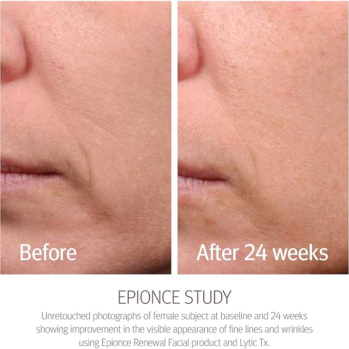 Epionce Renewal Facial Lotion, Anti-Aging Skin Barrier, Face Moisturizing Lotion with Vitamin C, Hyaluronic Acid, Malic Acid & Glycerin - Image 3