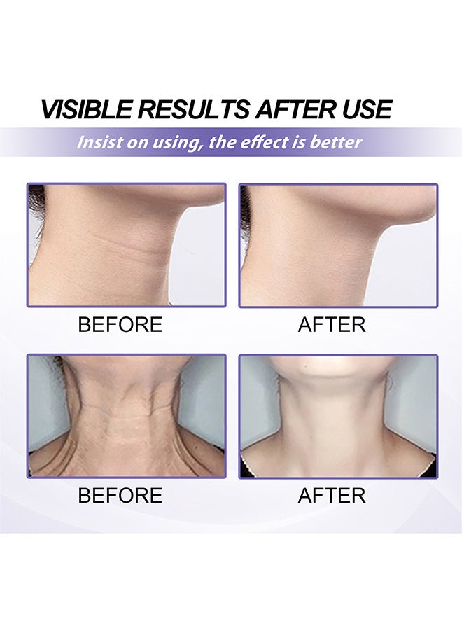 Retinol Neck Cream, Fade Neck Lines, Firming And Moisturizing Brighten Skin Neck Massage, Reshape Swan Neck 40G