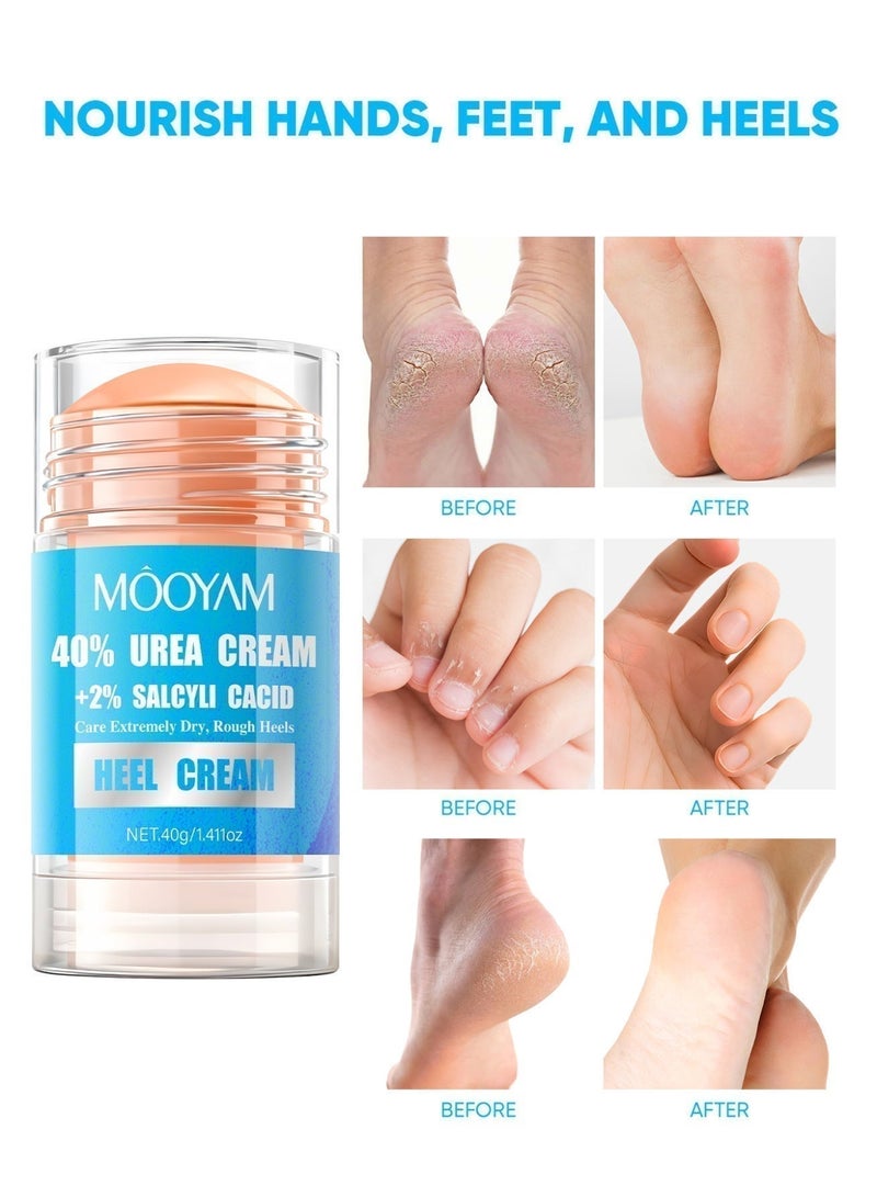 MOOYAM 40% Urea Cream with 2% Salcyli Cacid 40g Intensive Heel Repair Treatment for Extremely Dry Rough Cracked Heels and Feet Fast Absorbing Moisturizer - Image 1