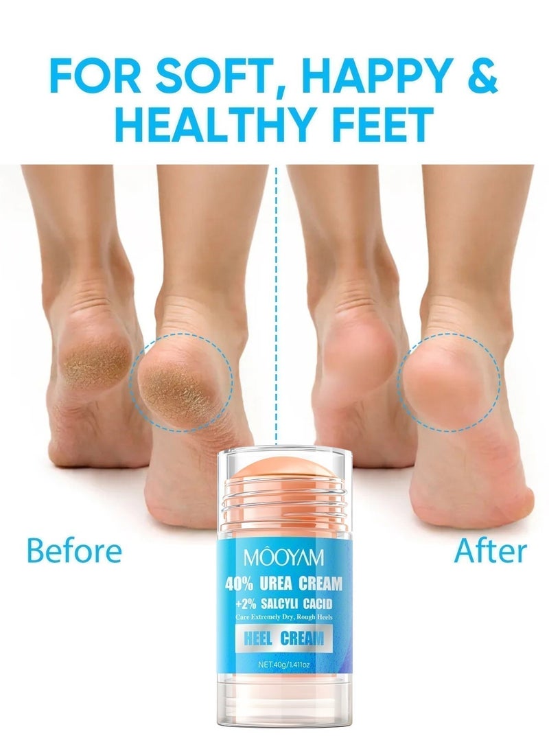 MOOYAM 40% Urea Cream with 2% Salcyli Cacid 40g Intensive Heel Repair Treatment for Extremely Dry Rough Cracked Heels and Feet Fast Absorbing Moisturizer - Image 3