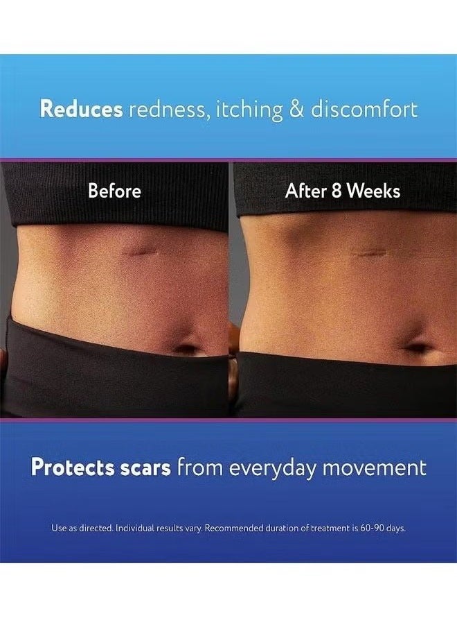 Kelo-cote Sinclair Gel for Scars 15g, Reduces the Appearance of Old New Scars, Stretch Marks, Surgery, Injuries, Burns and Acne  - Image 5